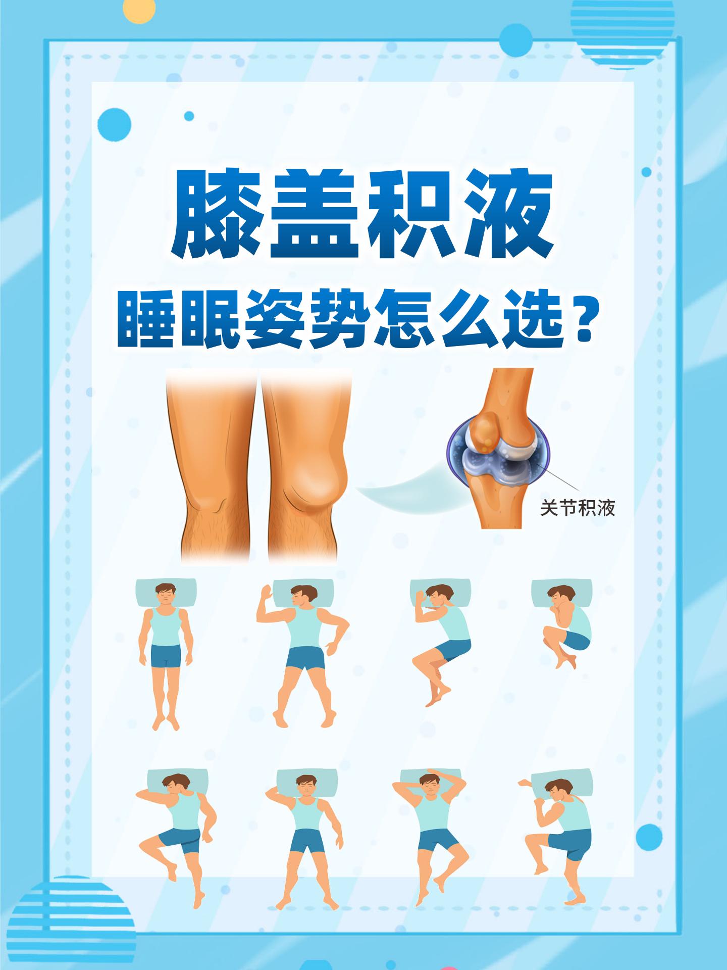 膝盖积水怎么治疗