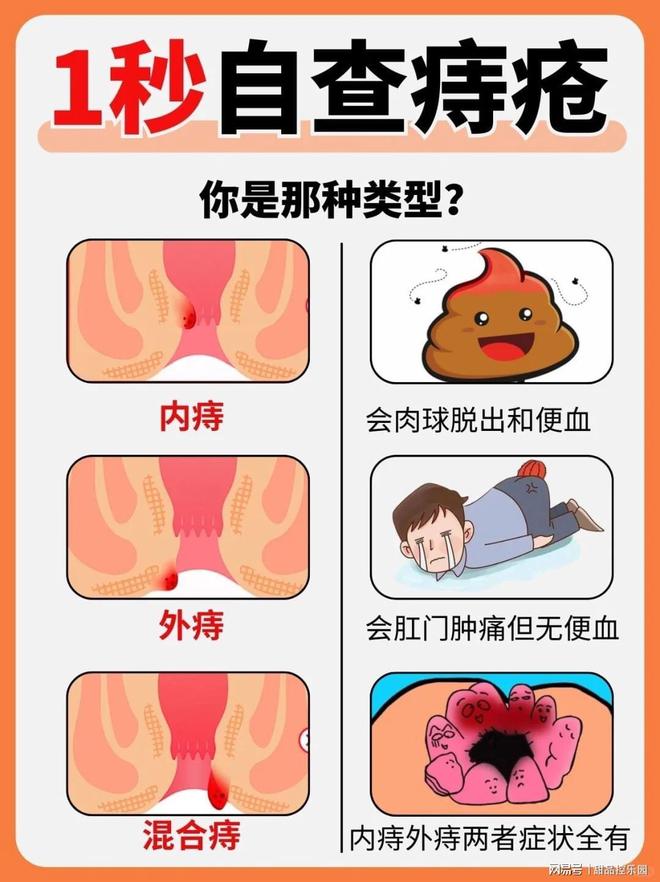 内痔和外痔的区别