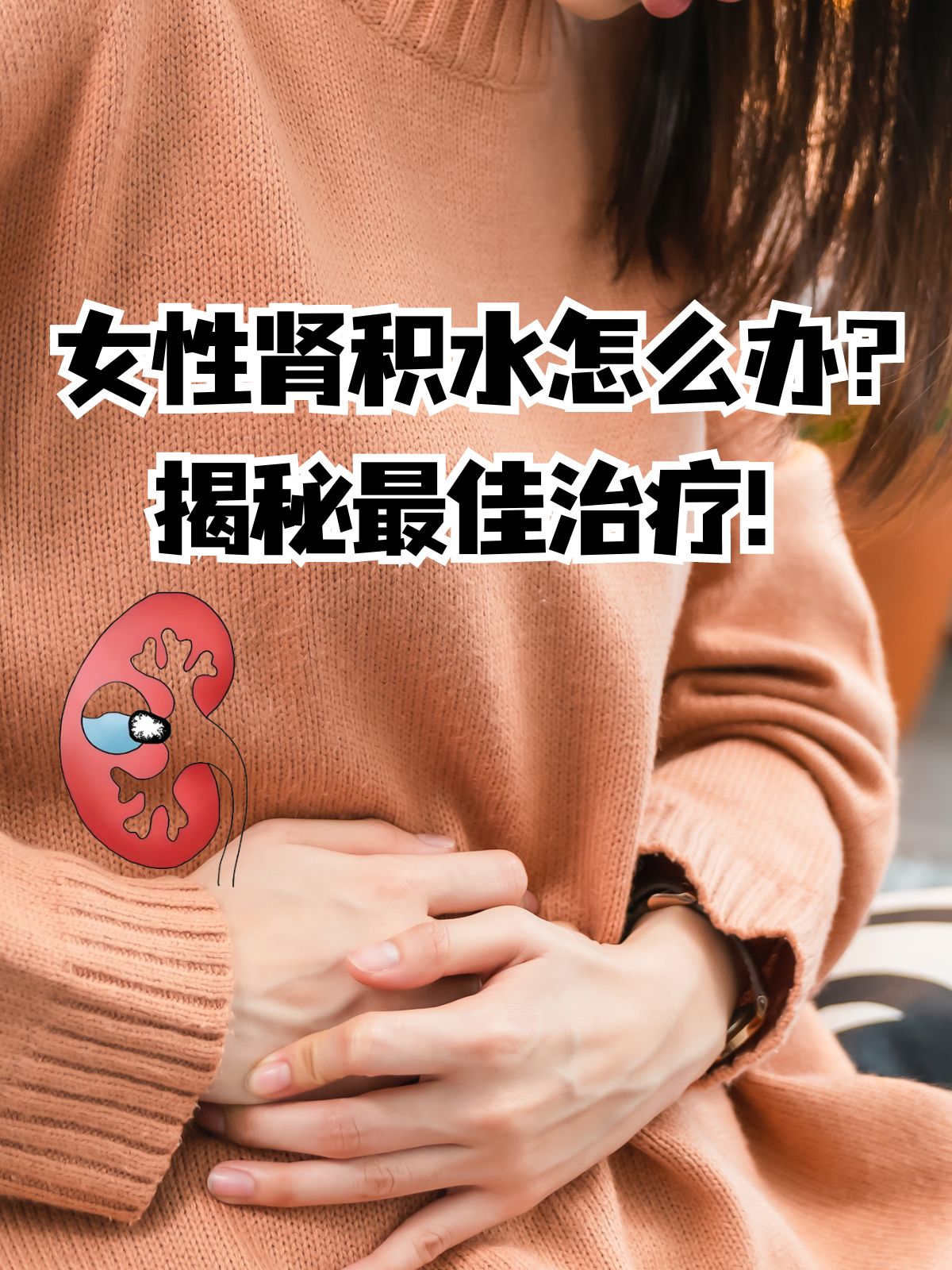 肾积水怎么治疗比较好?