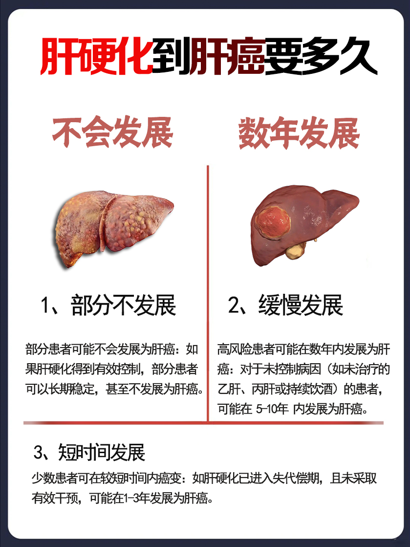 肝硬化能治愈吗?