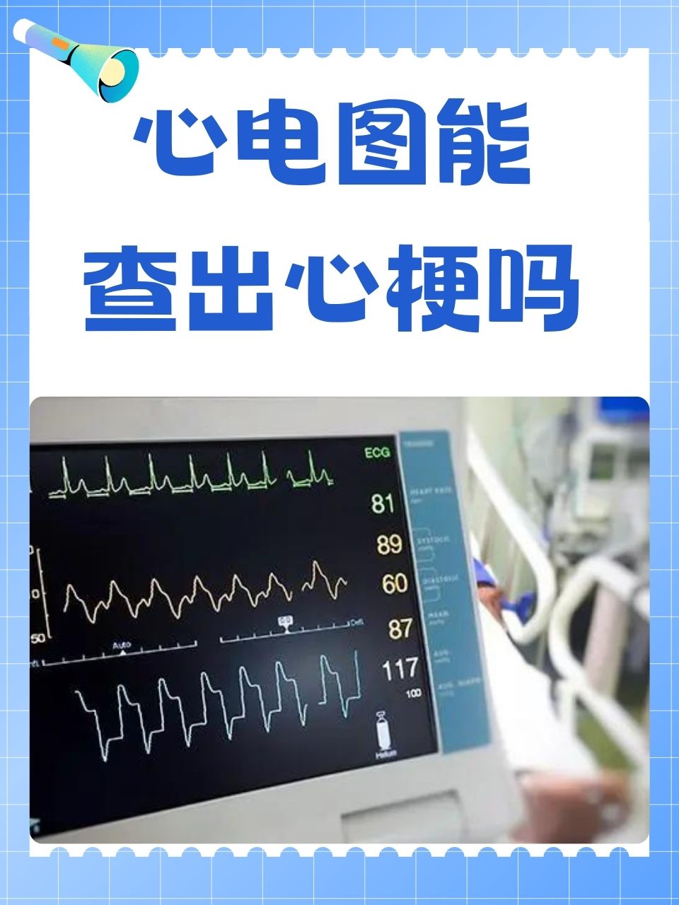 心梗能活多久