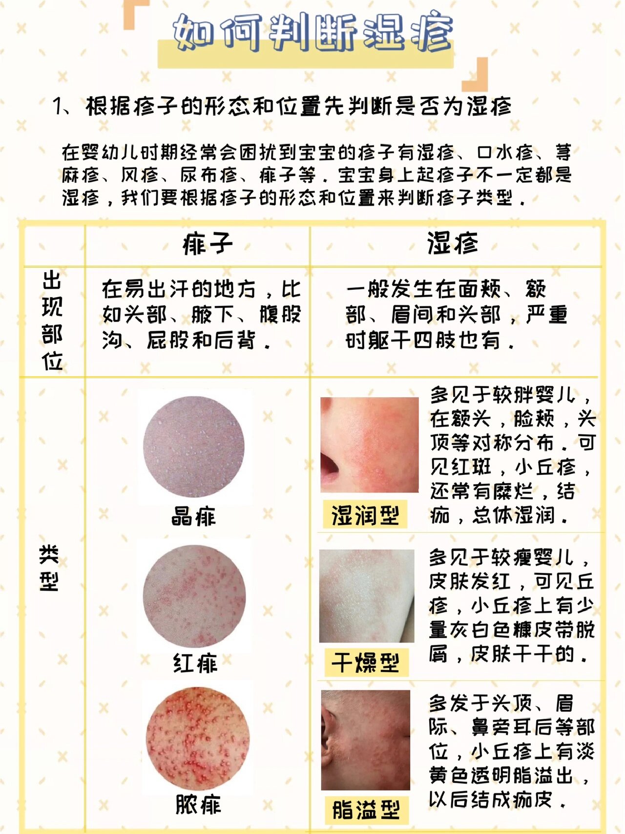 宝宝起痱子怎么办
