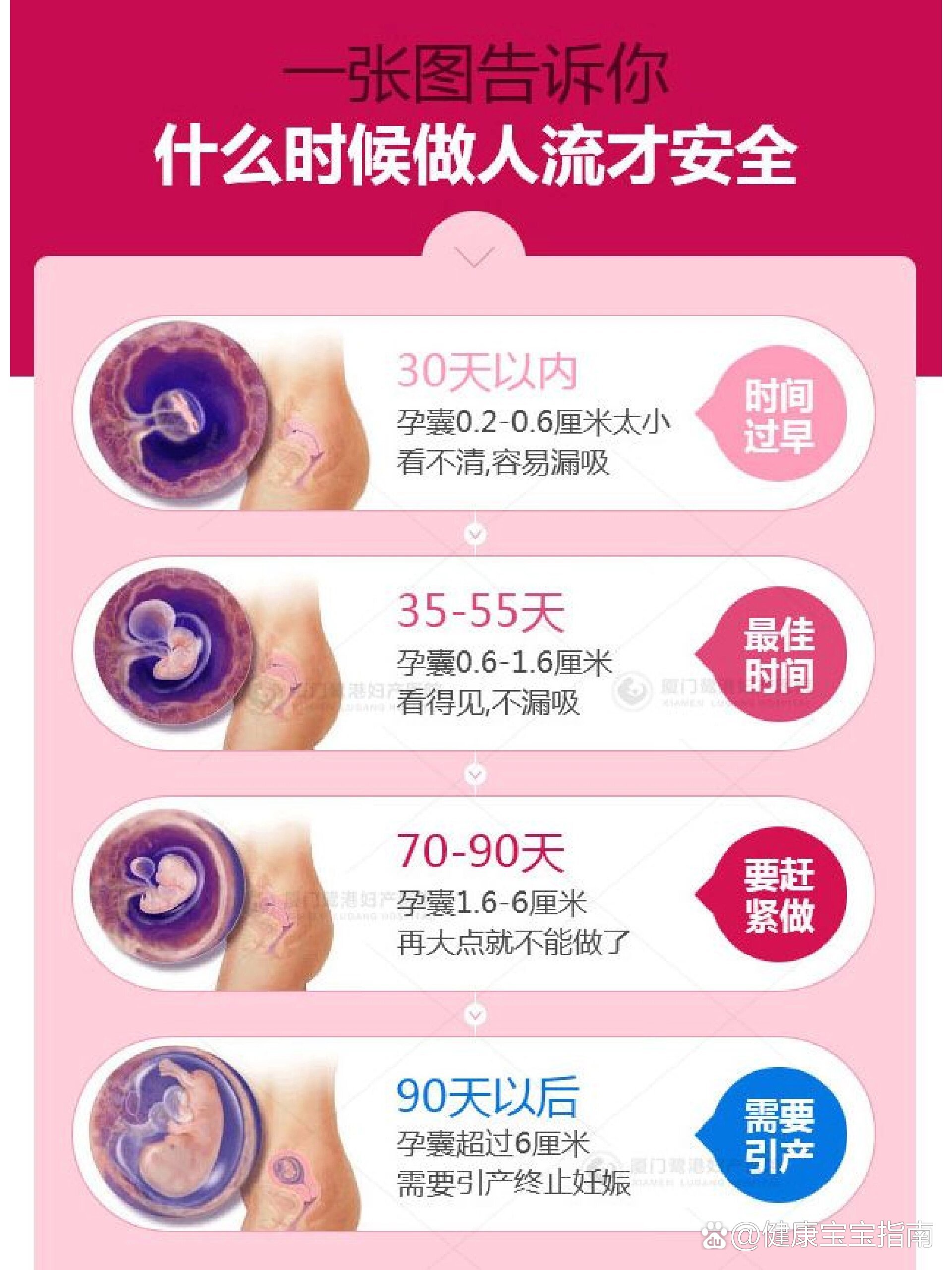无痛人流手术需要多久