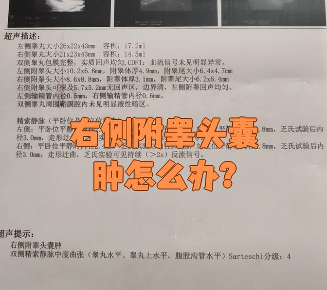 附睾囊肿影响生育吗,