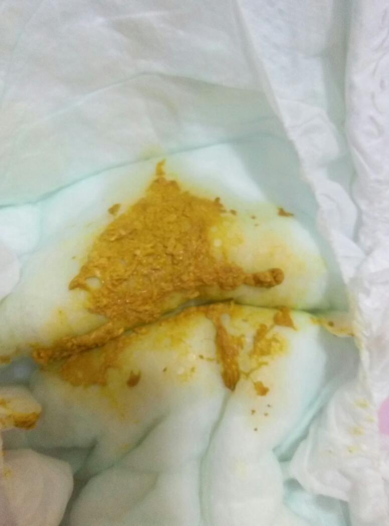 宝宝便便有白色正常吗