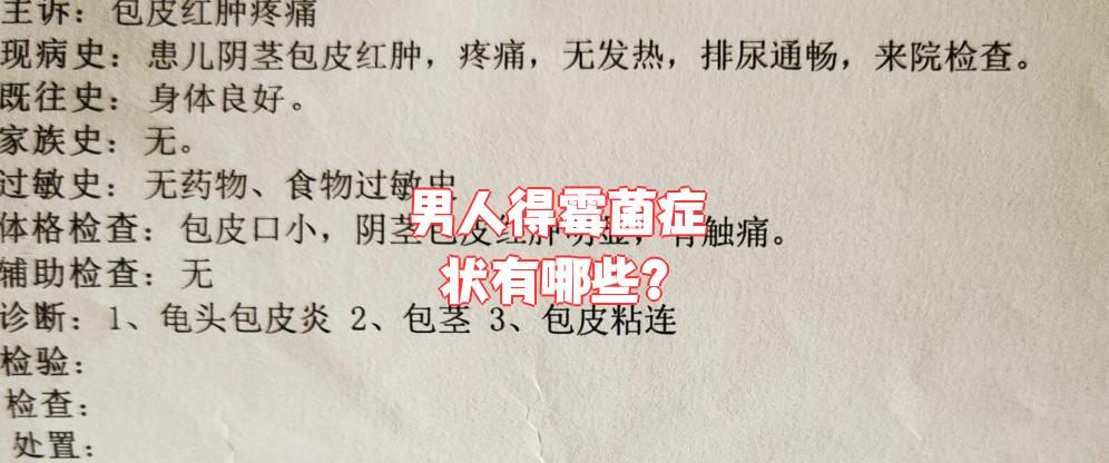 男人感染霉菌的症状有哪些