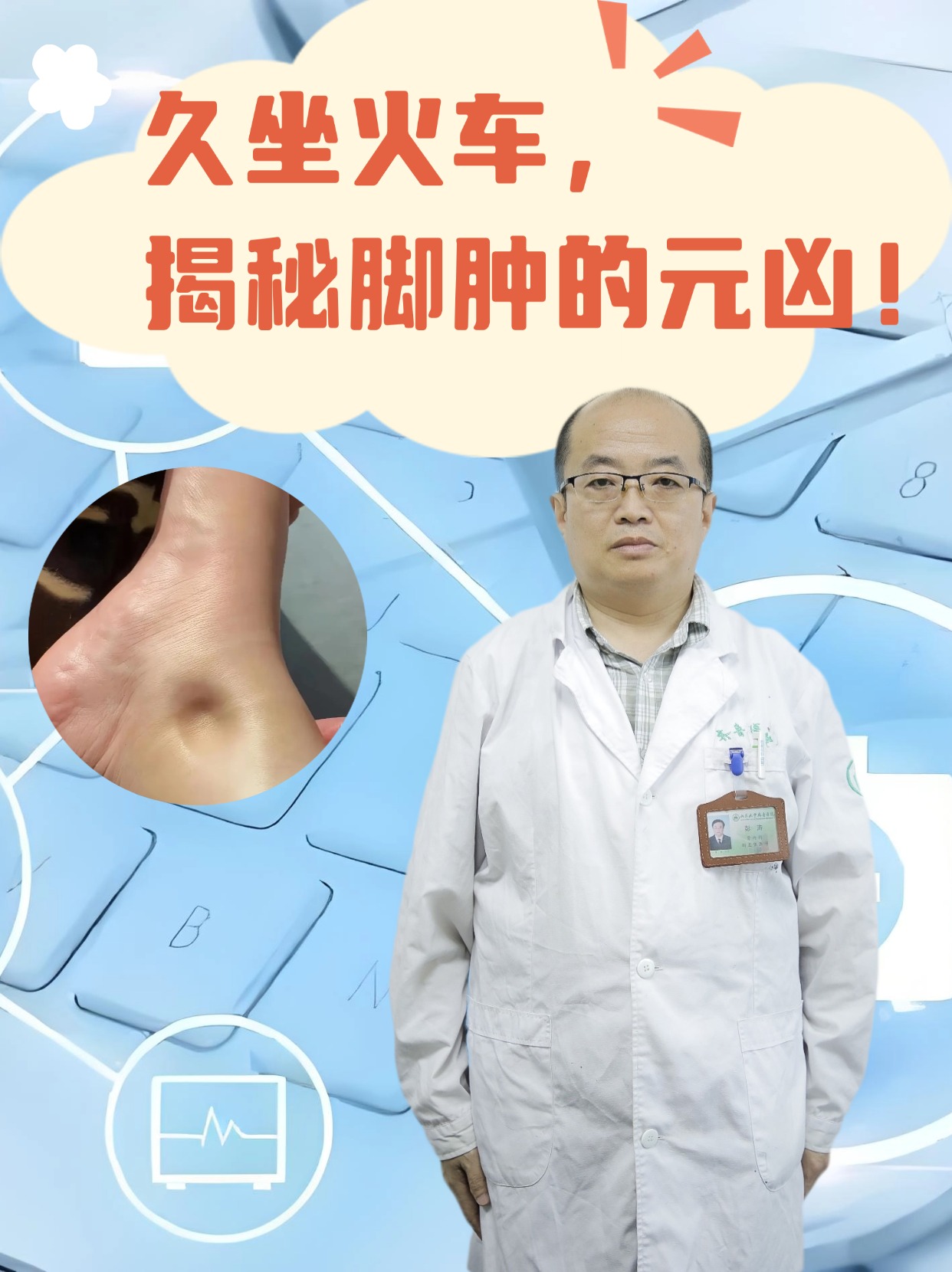 脚肿是因什么原因引起的