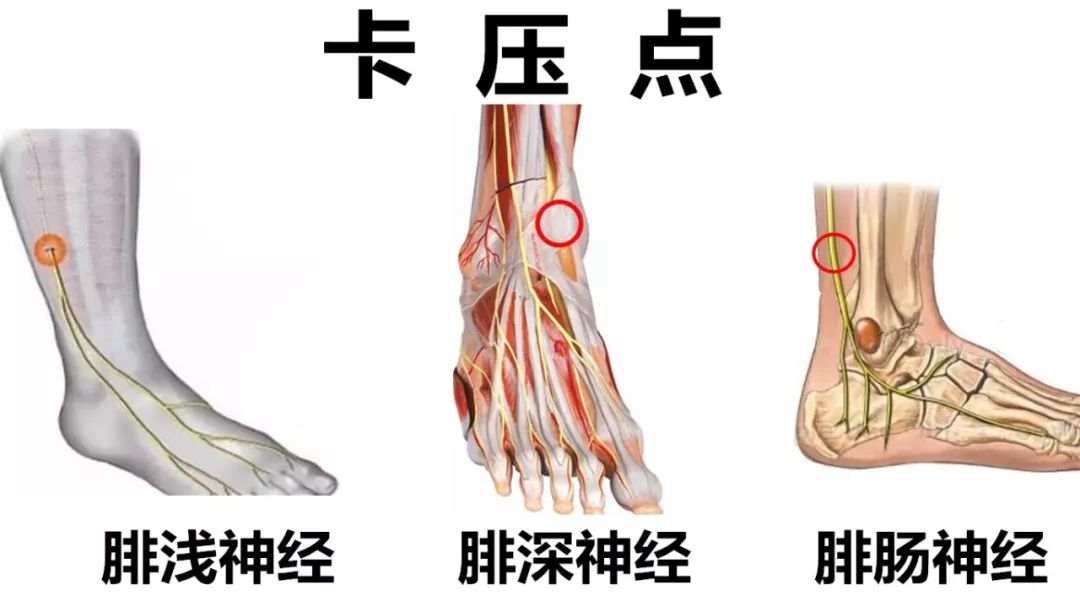 腓总神经解剖位置在哪里?