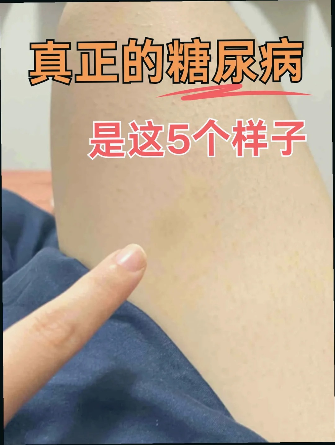 口干舌燥,是什么原因引起的