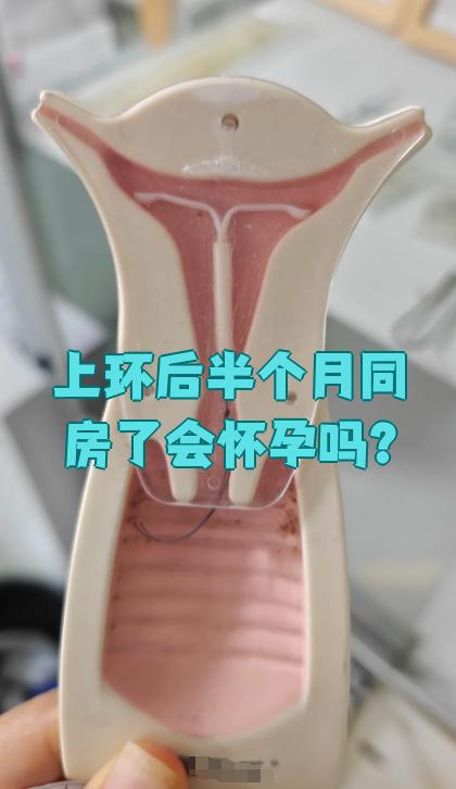 上环还能怀孕吗