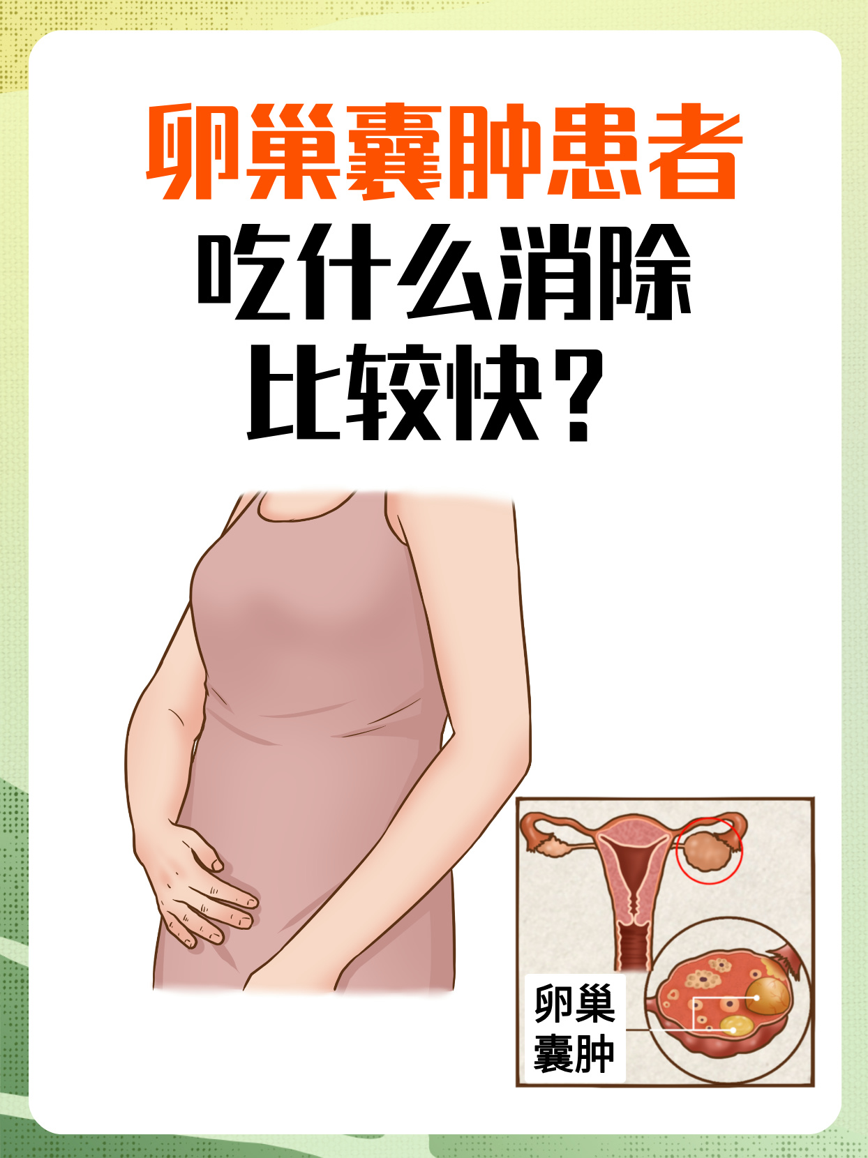 黄体囊肿是怎么形成的