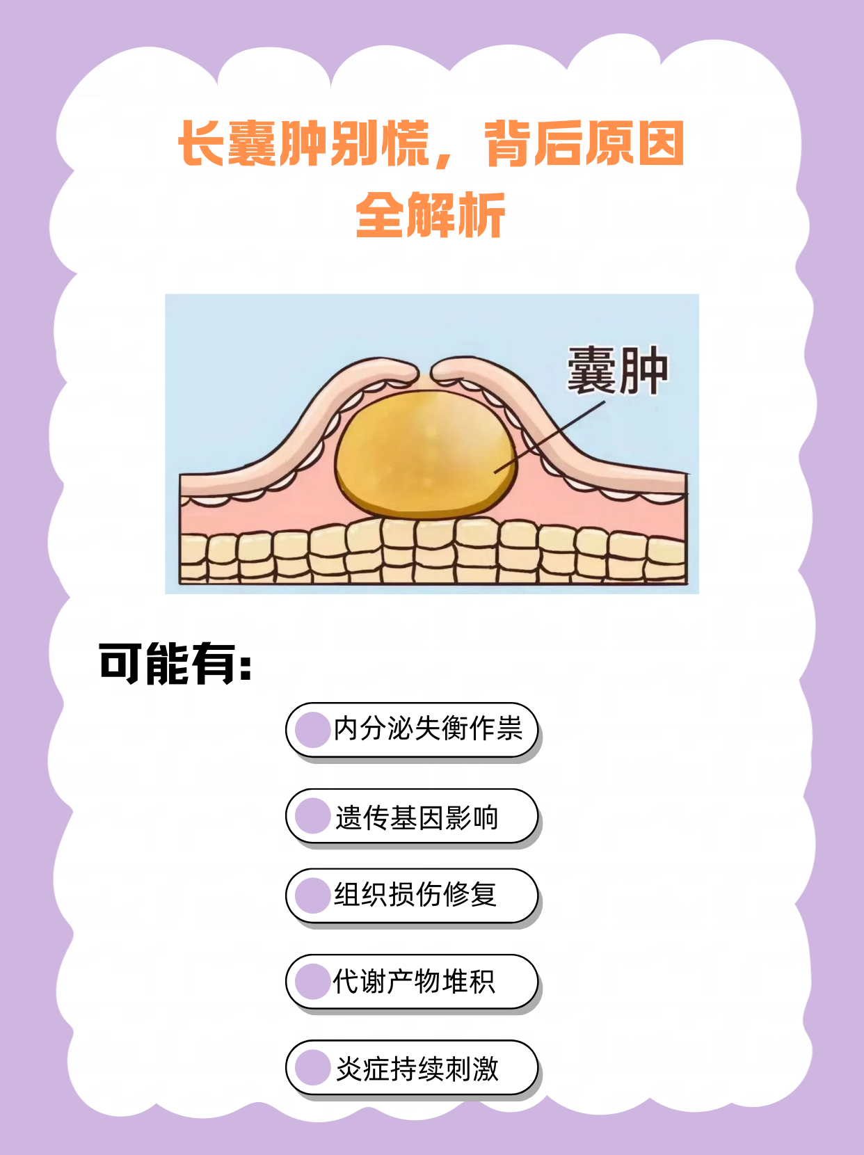 囊肿和肿瘤怎么区分