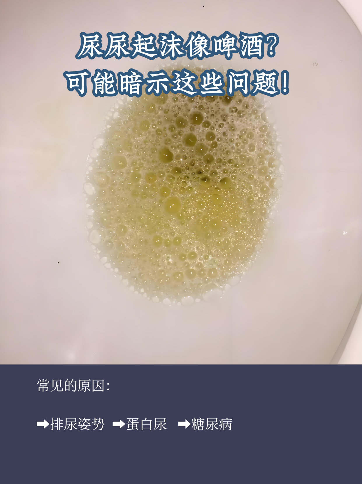 尿液发黄有泡沫?