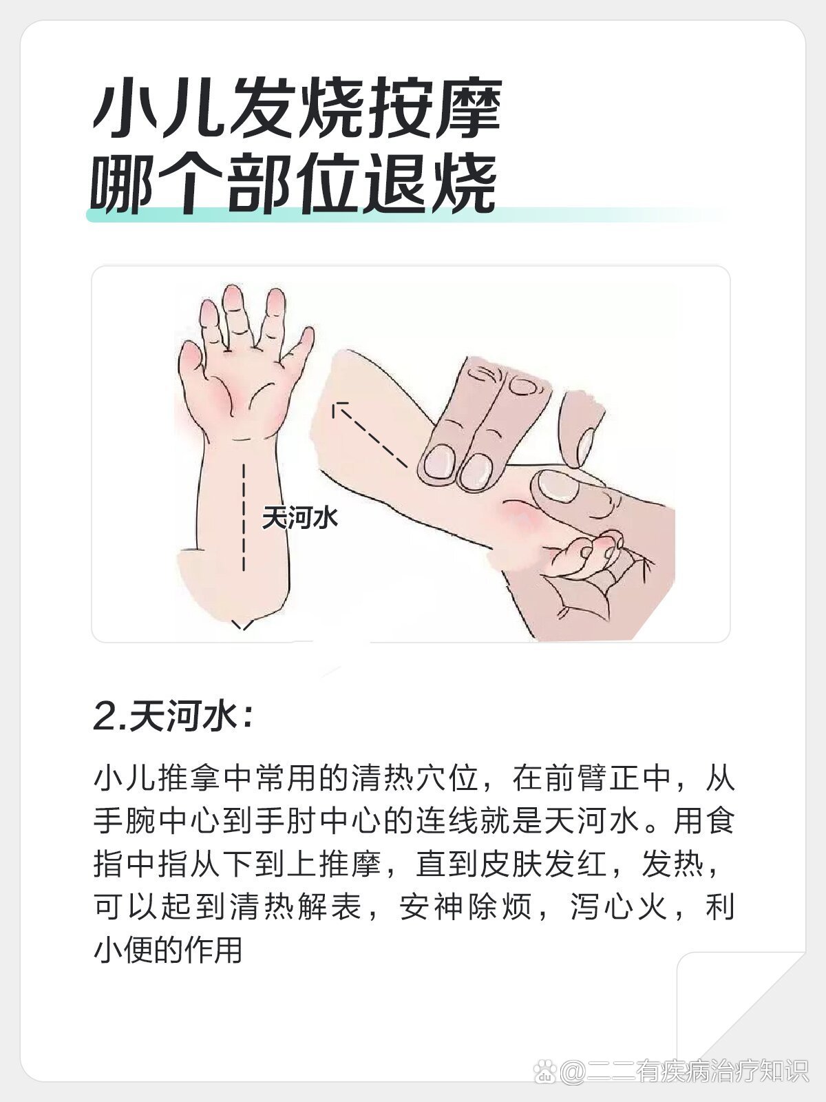 儿童退烧推拿