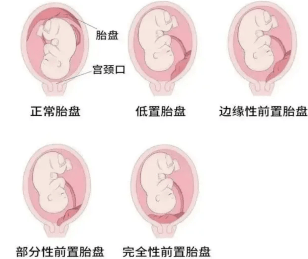 辛晶燕 第2页