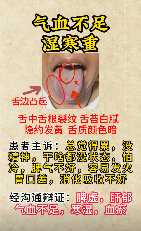 舌头中间发黑是怎么回事