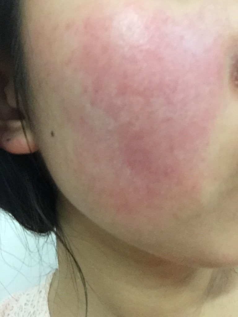 医生,您好!请问有一种叫康美丹的药,是治