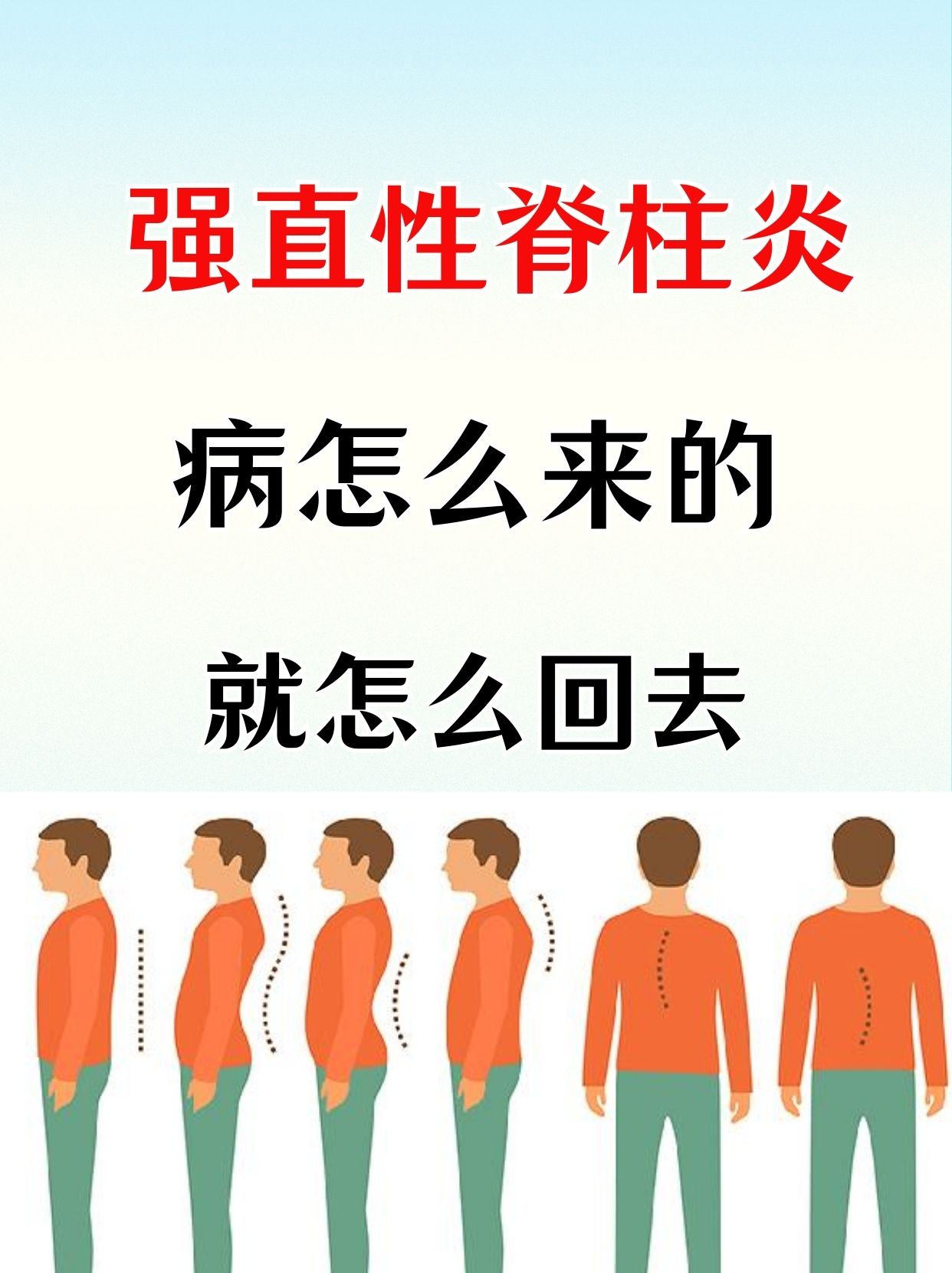 强直40岁后不再发病么?