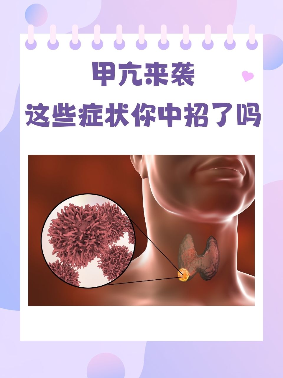 甲状腺疾病症状有哪些