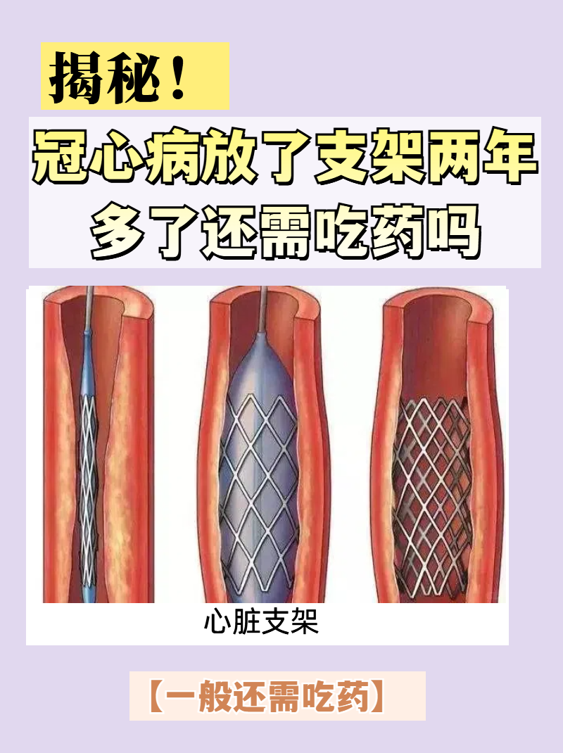 得了冠心病严重吗