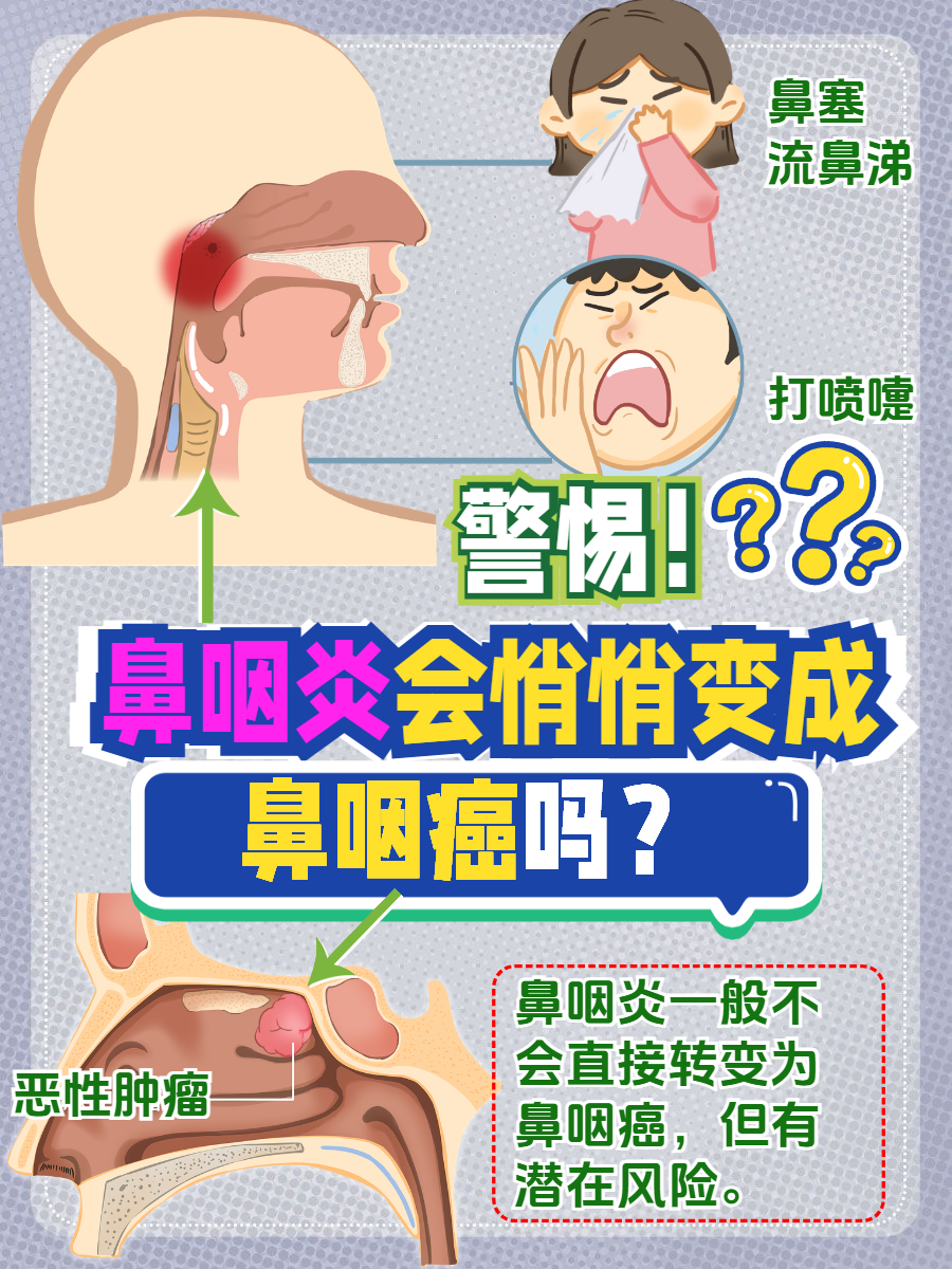 鼻咽炎症状有哪些