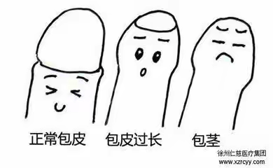 小儿包皮过长