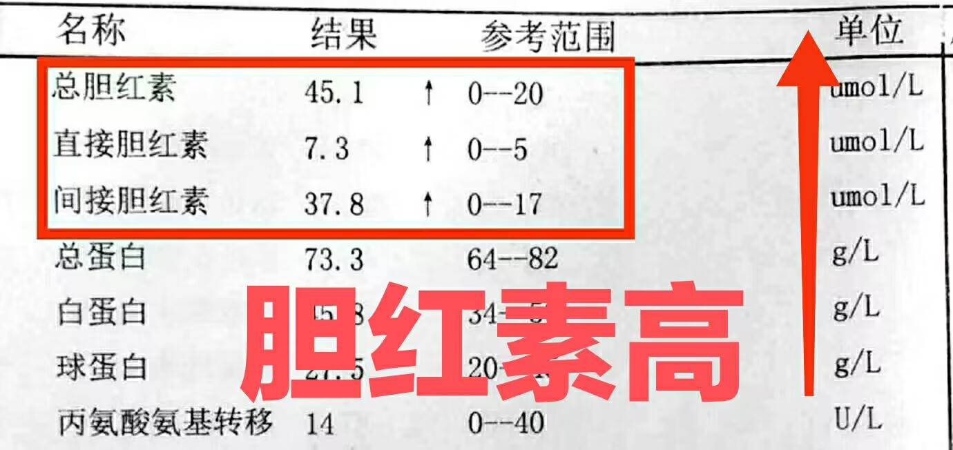 总胆红素和直接胆红素偏高是什么原因