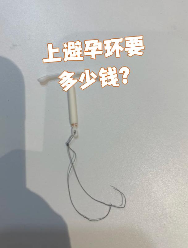 节育环多少钱?
