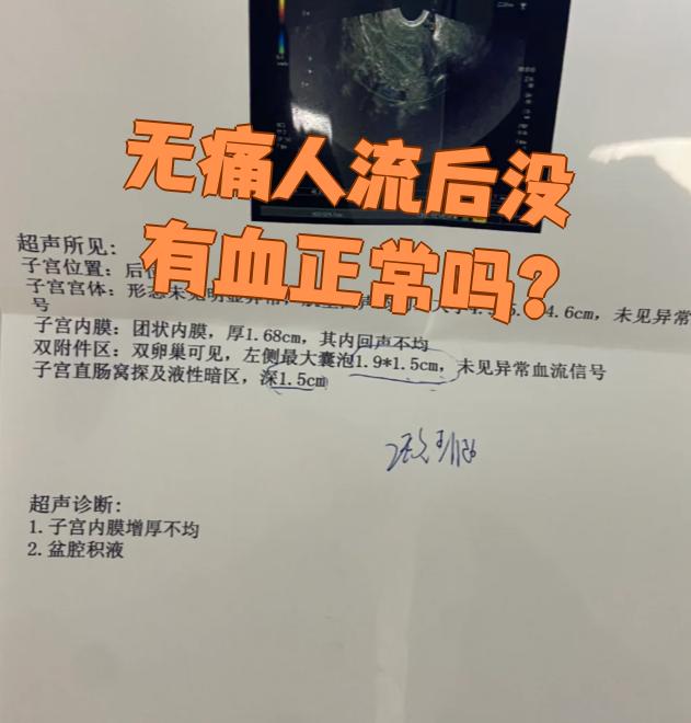 无痛人流后几天不在流血