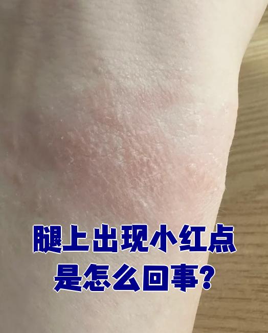 腿上有红点是怎么回事