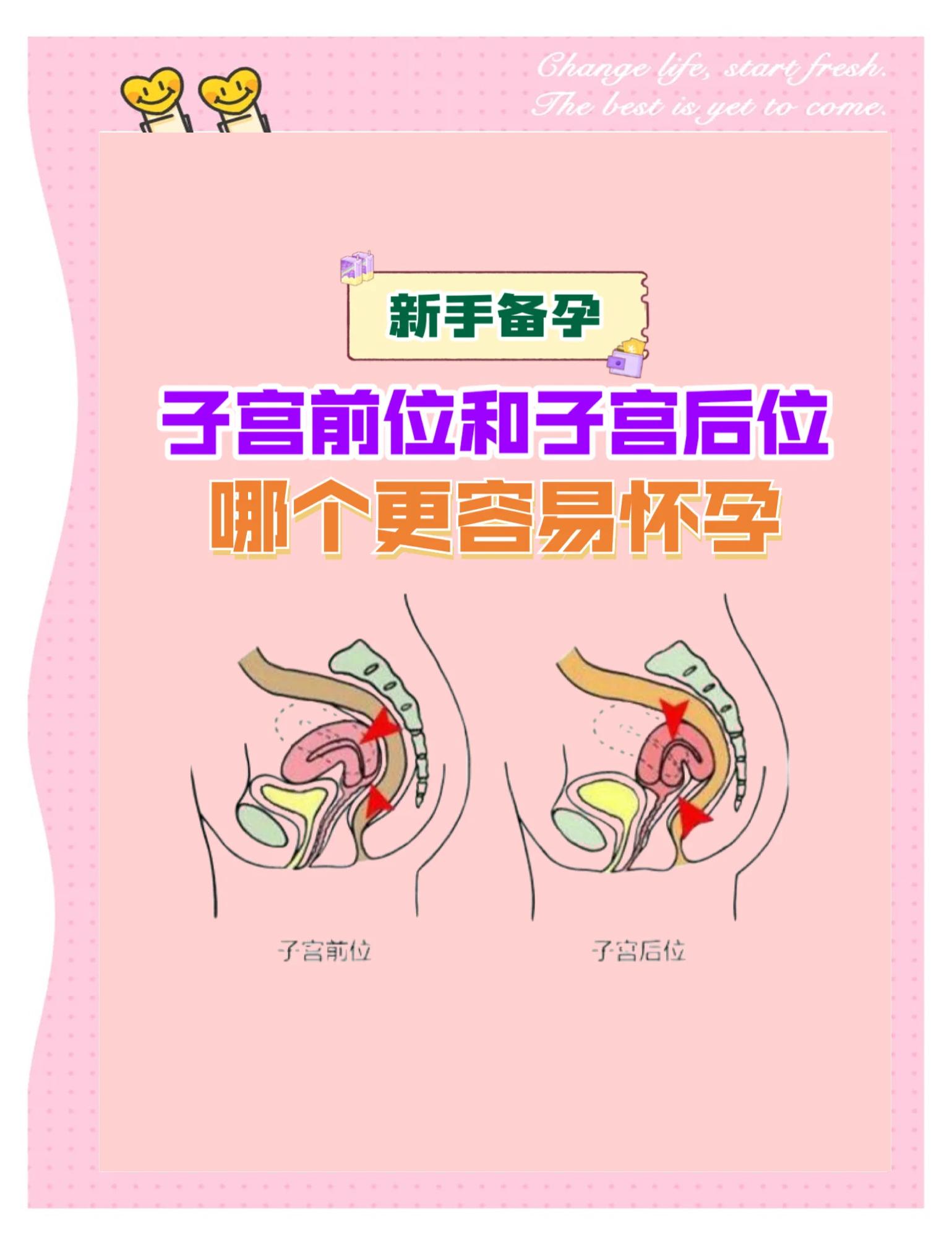 子宫前卫是什么意思啊?