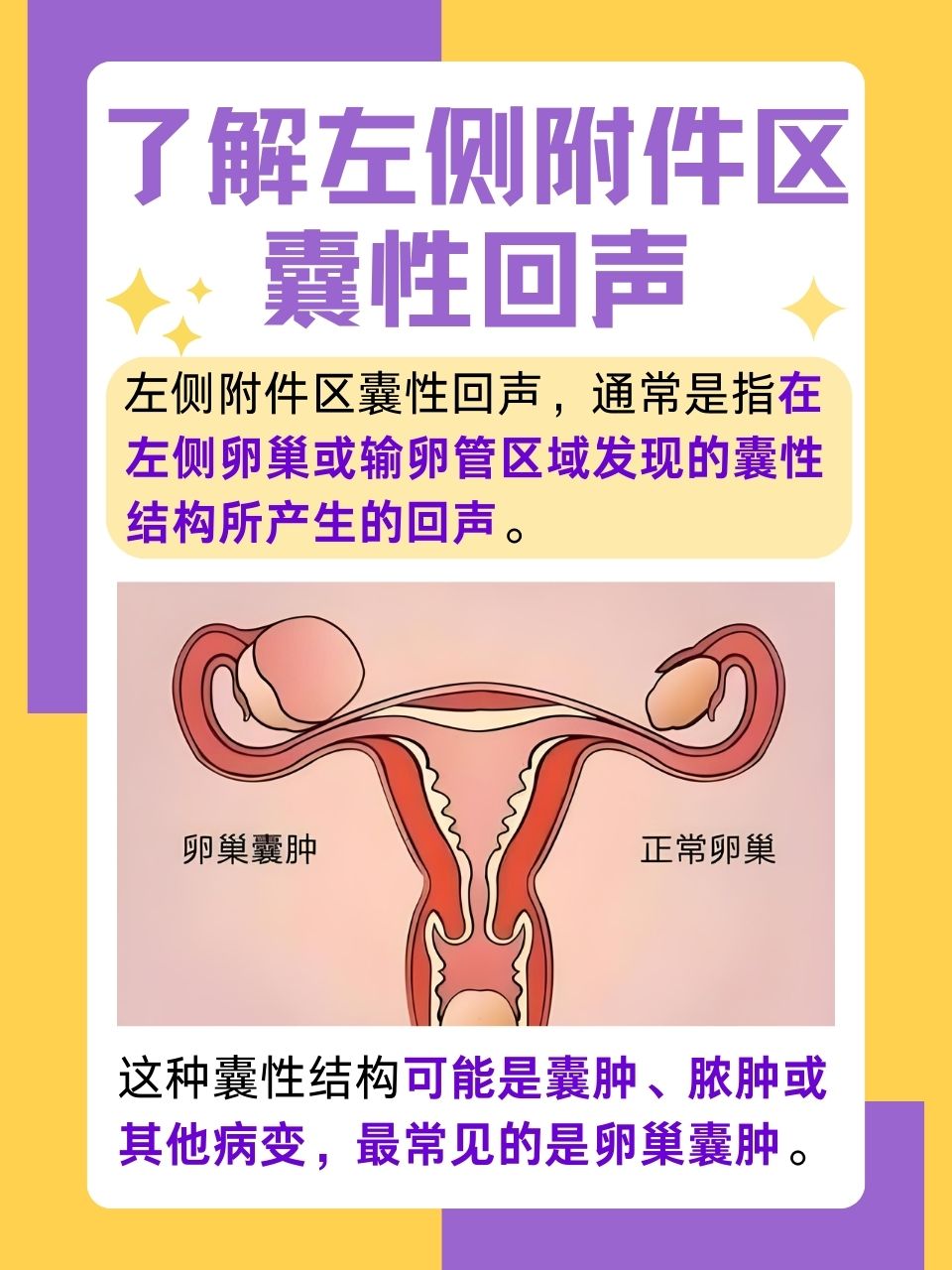右侧附件区囊肿怎么回事?