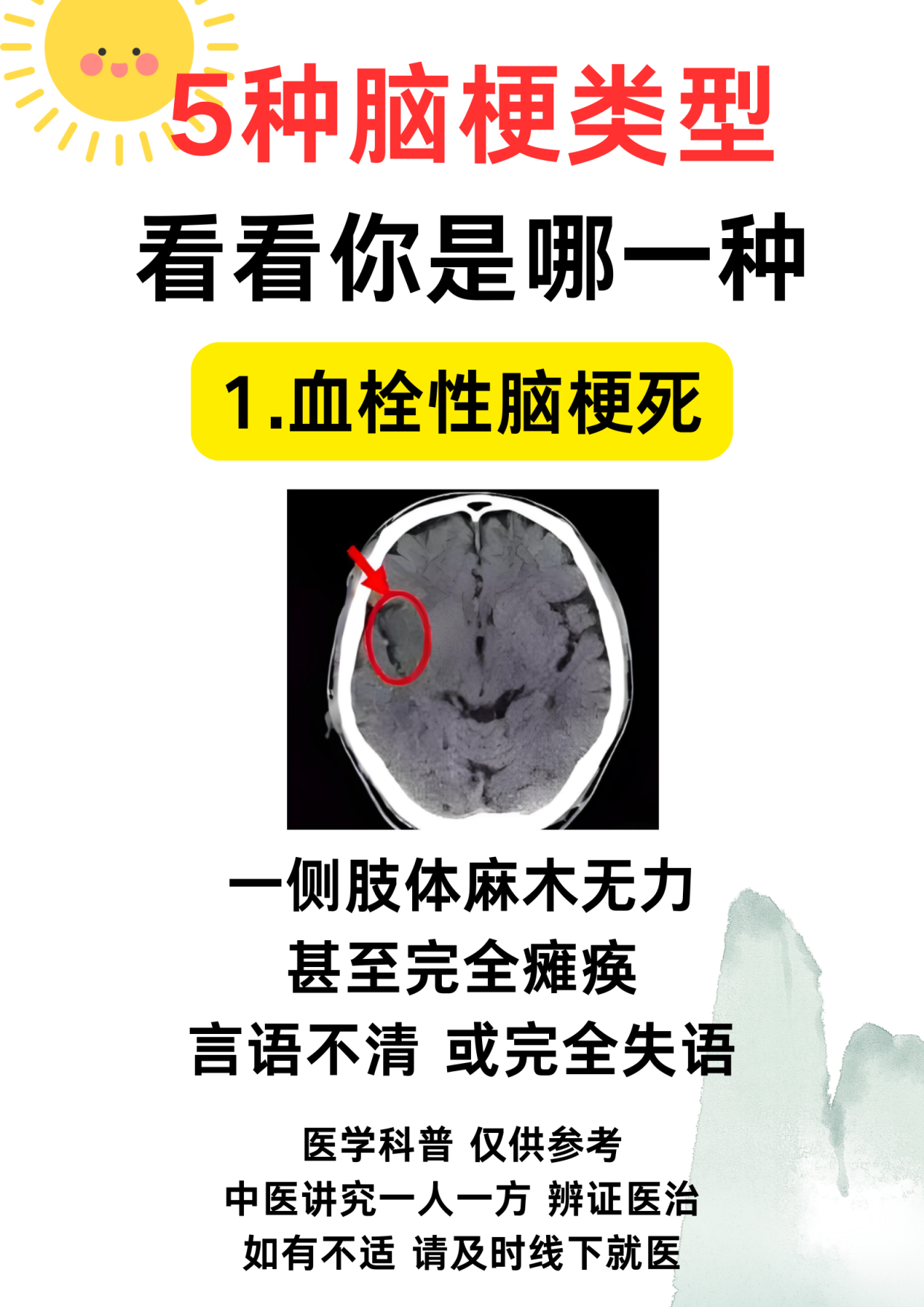 脑梗塞后遗症有哪些?