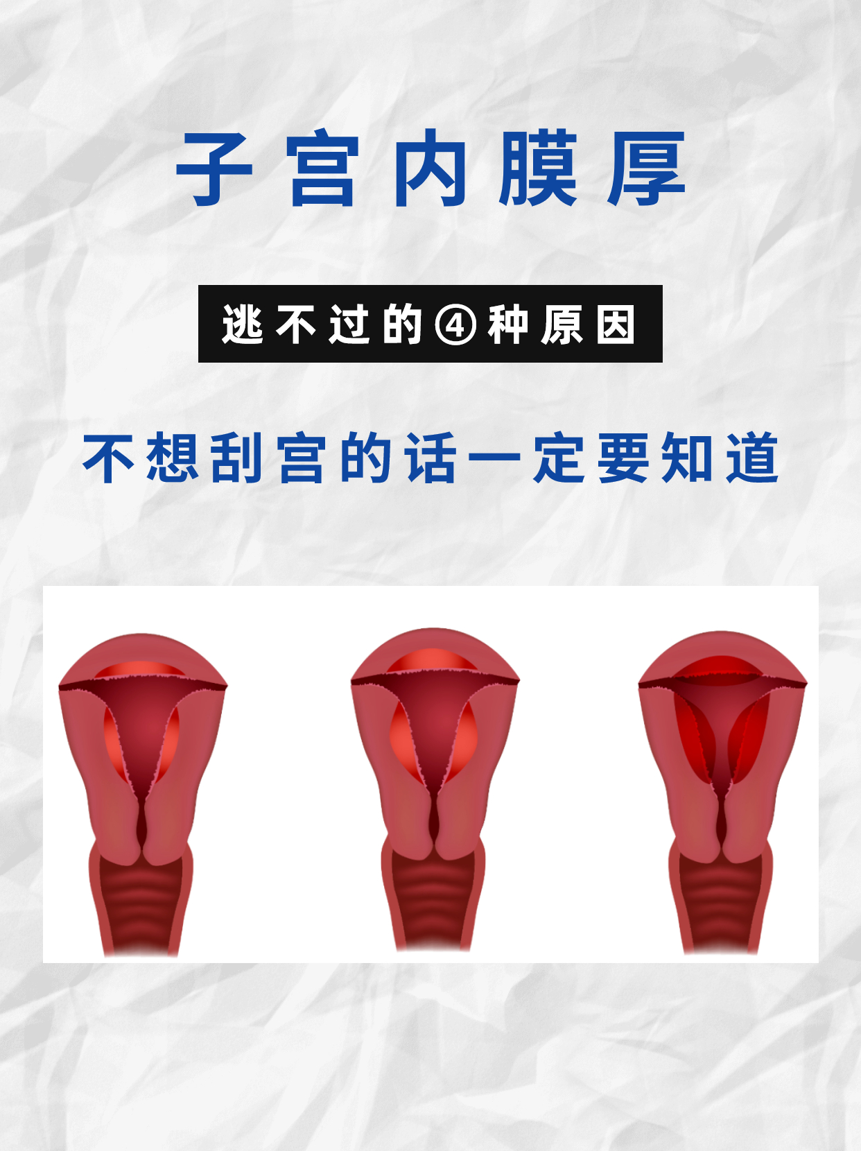 在平时内膜多厚正常.
