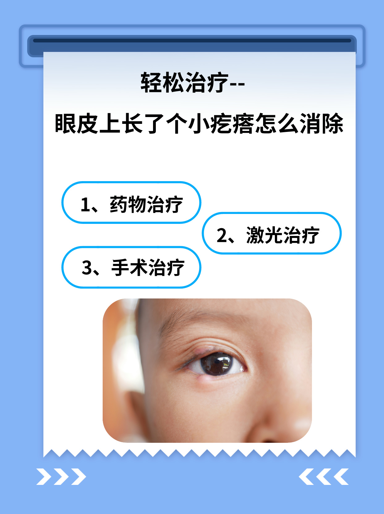 针眼怎么治疗