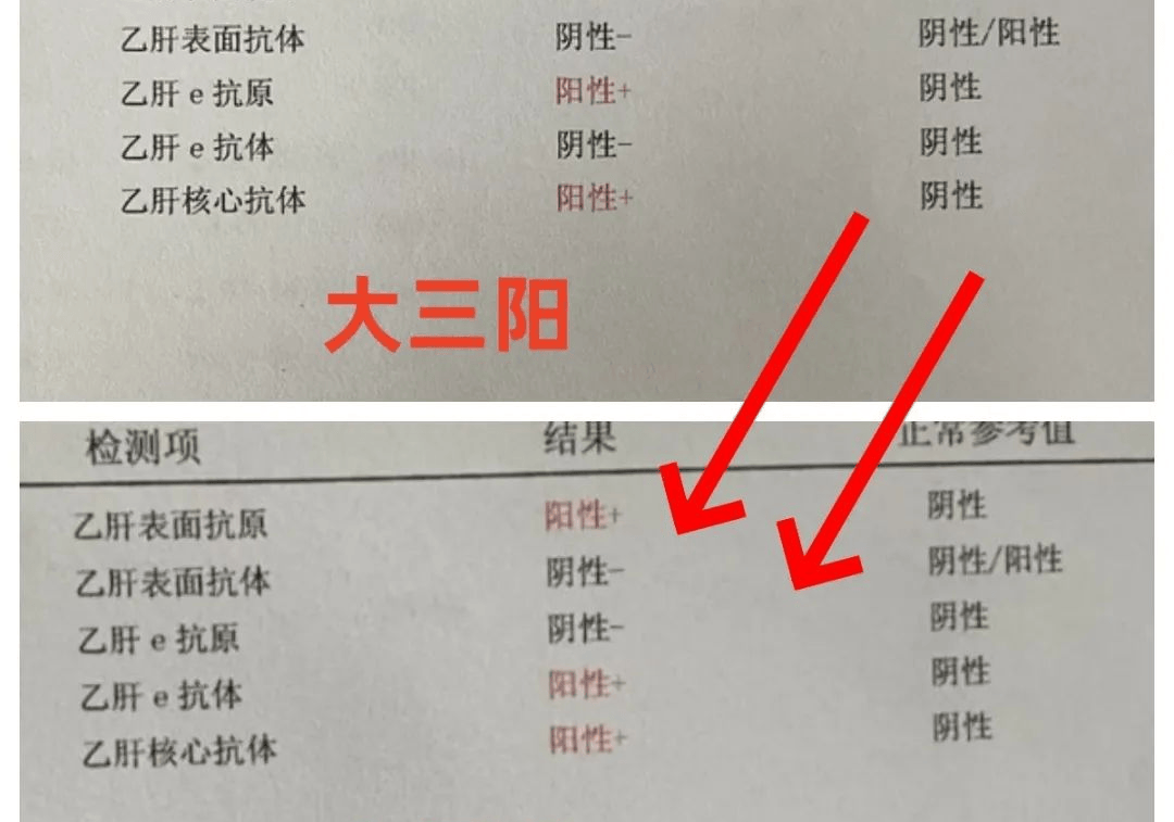女性得乙肝能活多少年