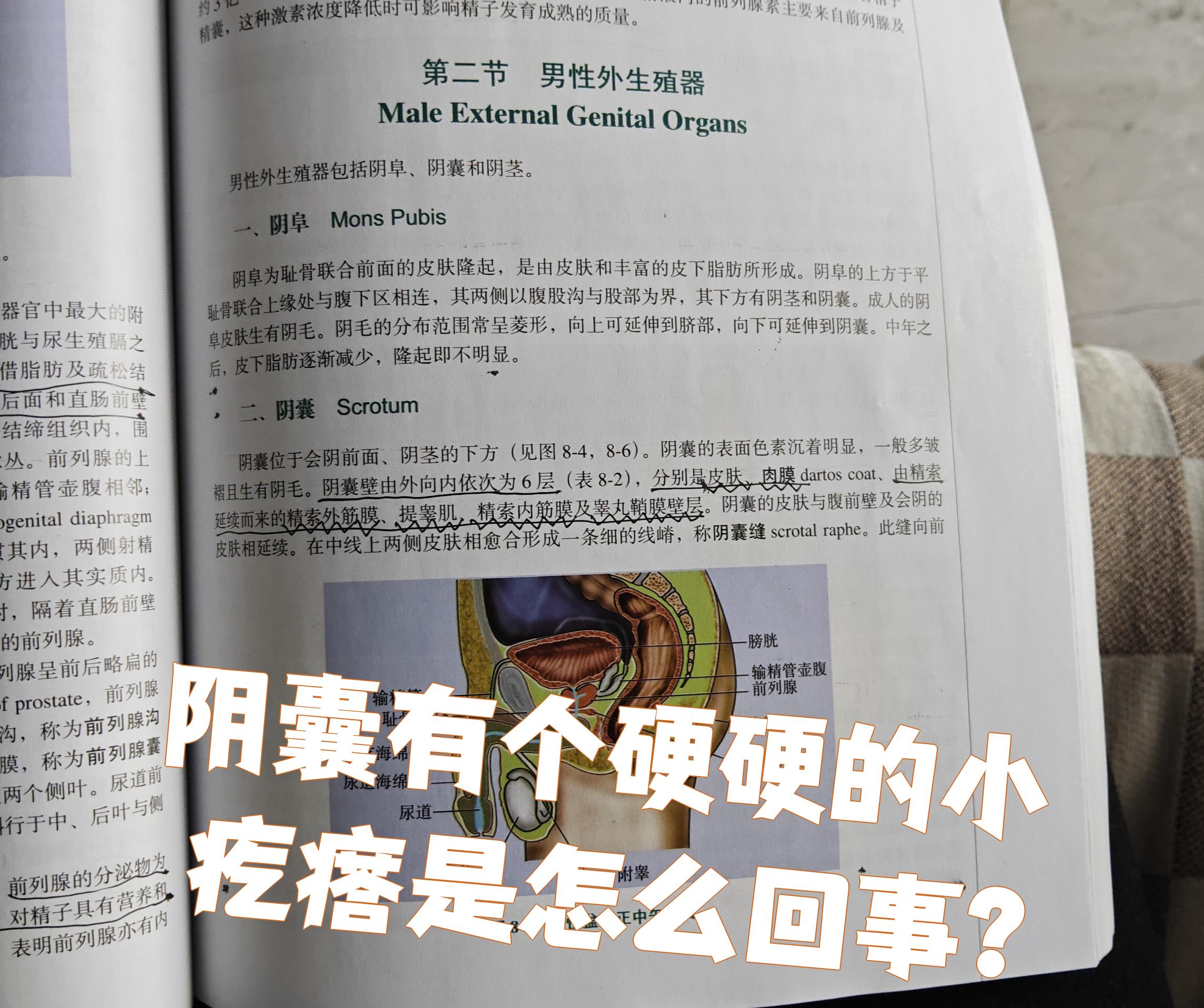 精囊肿怎么回事