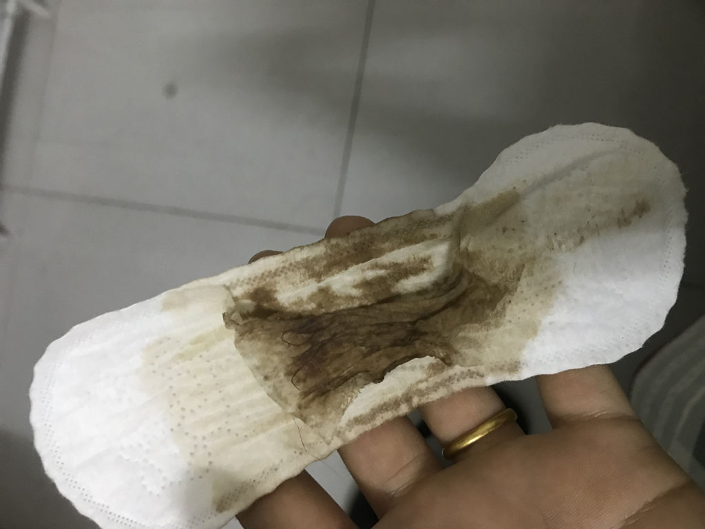 流产后来月经量多鲜红