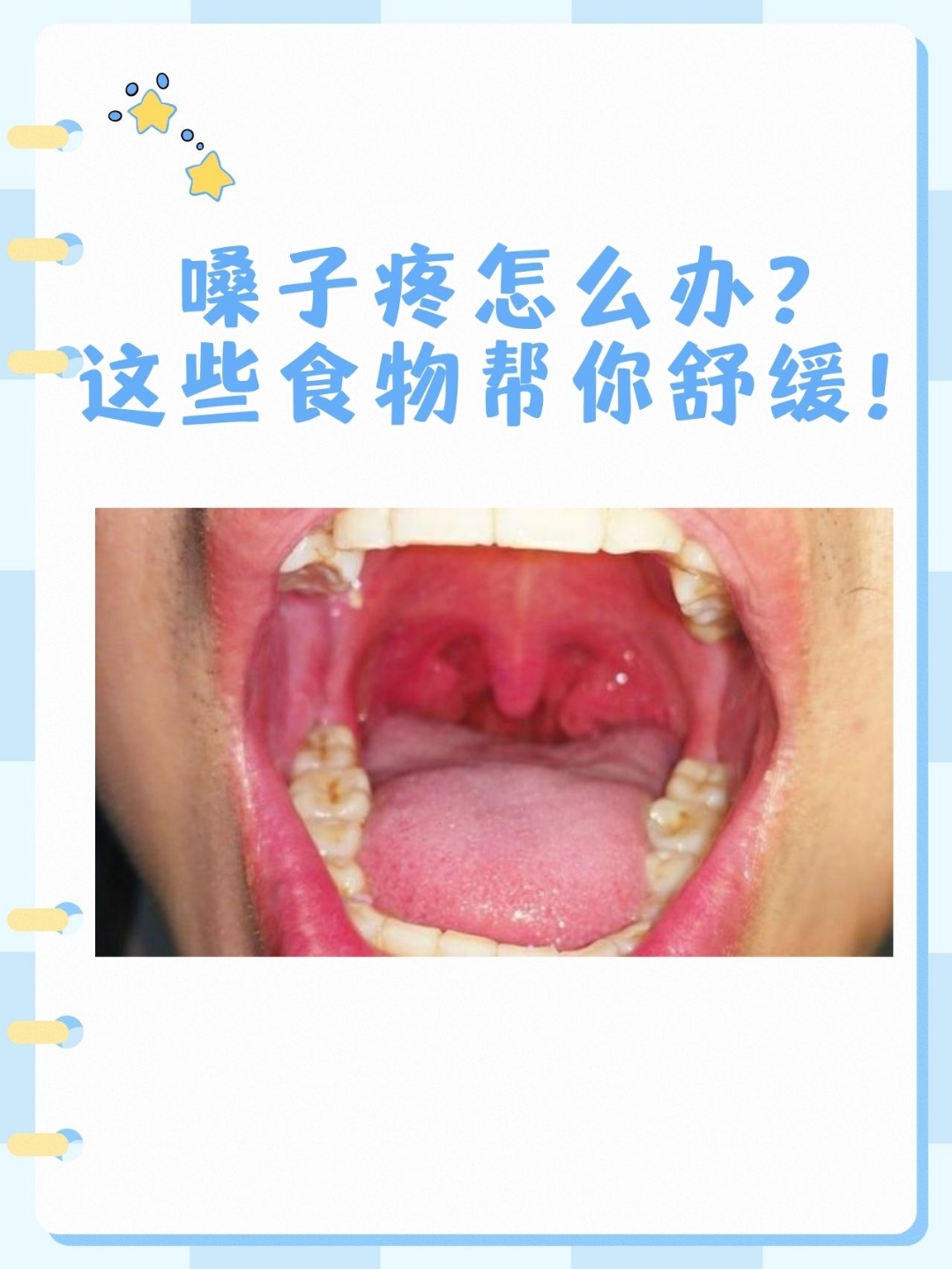 嗓子疼怎么办最简单的方法
