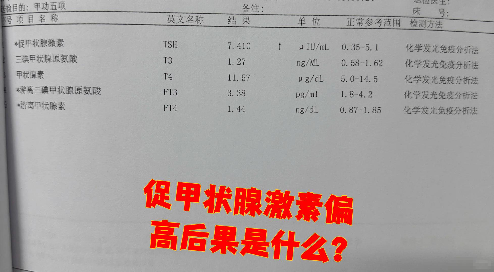 促甲状腺激素偏高