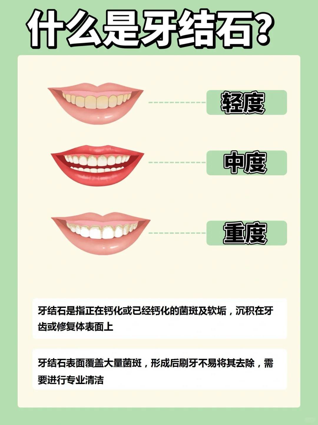 为什么容易长牙结石