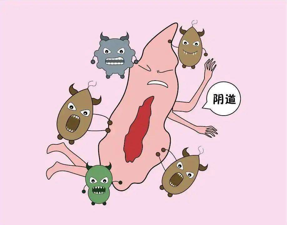 孕妇外阴瘙痒怎么办