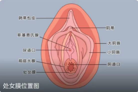 怎么自己辨别是否还有处女膜