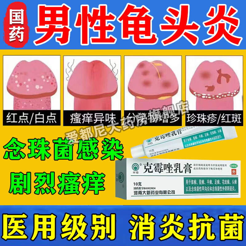 念珠菌性龟头炎用什么药?