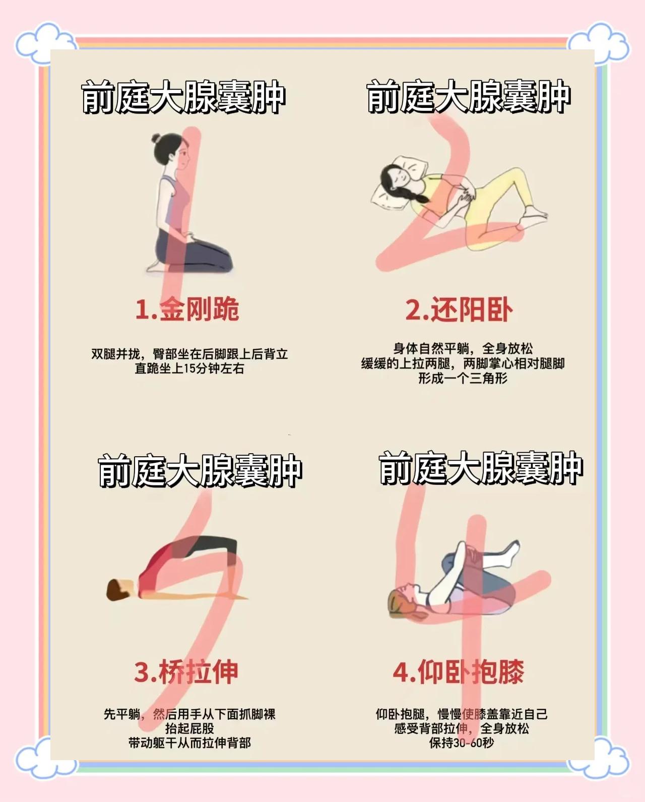 巴氏腺囊肿保守治疗方法