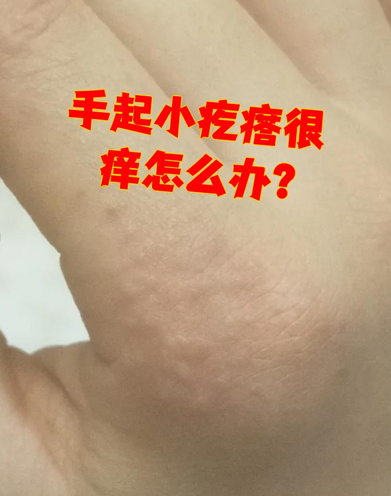 接触性皮炎可以自愈吗
