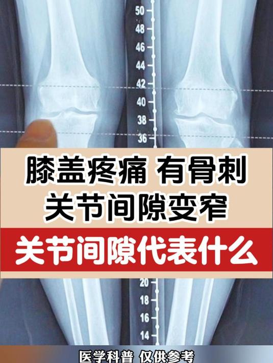 膝关节骨质增生是怎么回事?