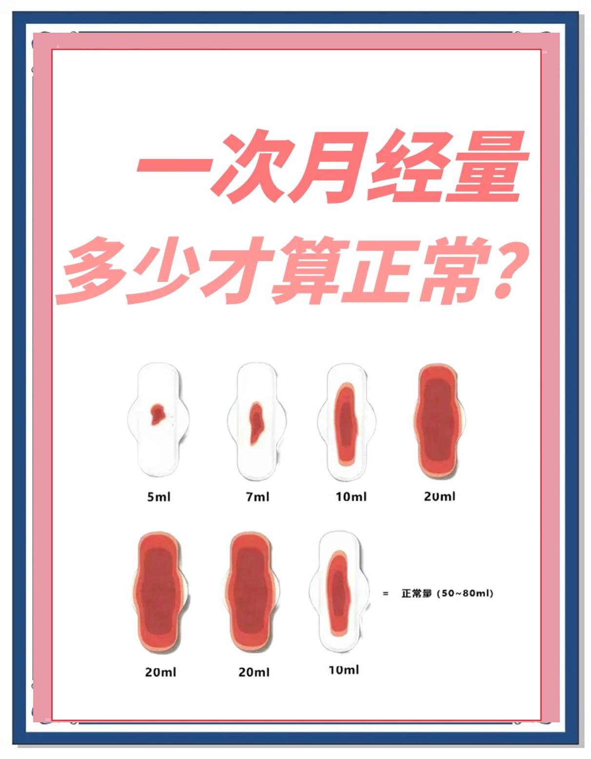 经量多少算正常