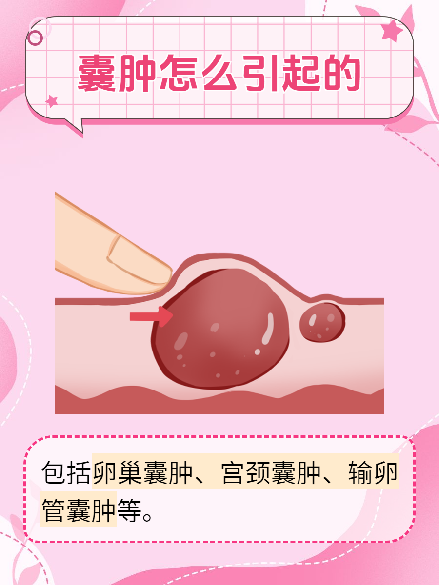 卵巢囊肿的治疗方法