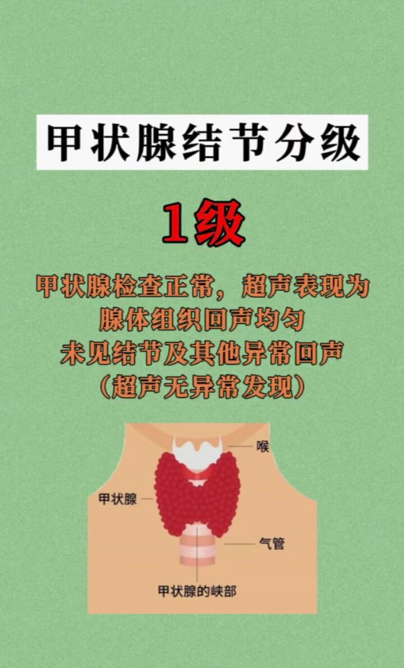 甲状腺结节应该挂什么科?